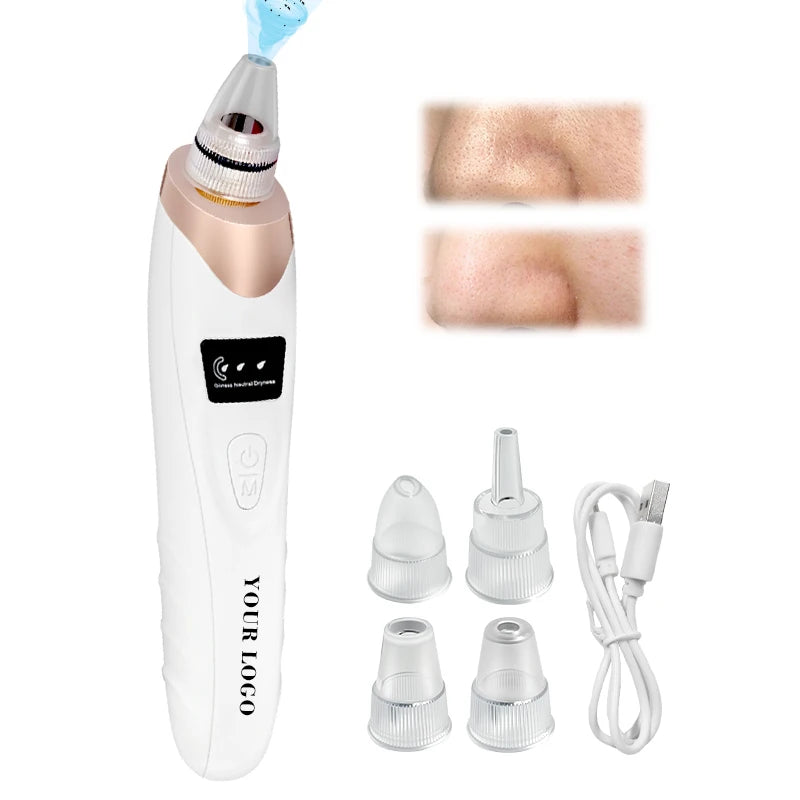Wholesale Electric Acne Extractor Tool Facial Pore Cleaner Pore Vacuum Blackhead Remover with 3 Adjustable Suction Levels