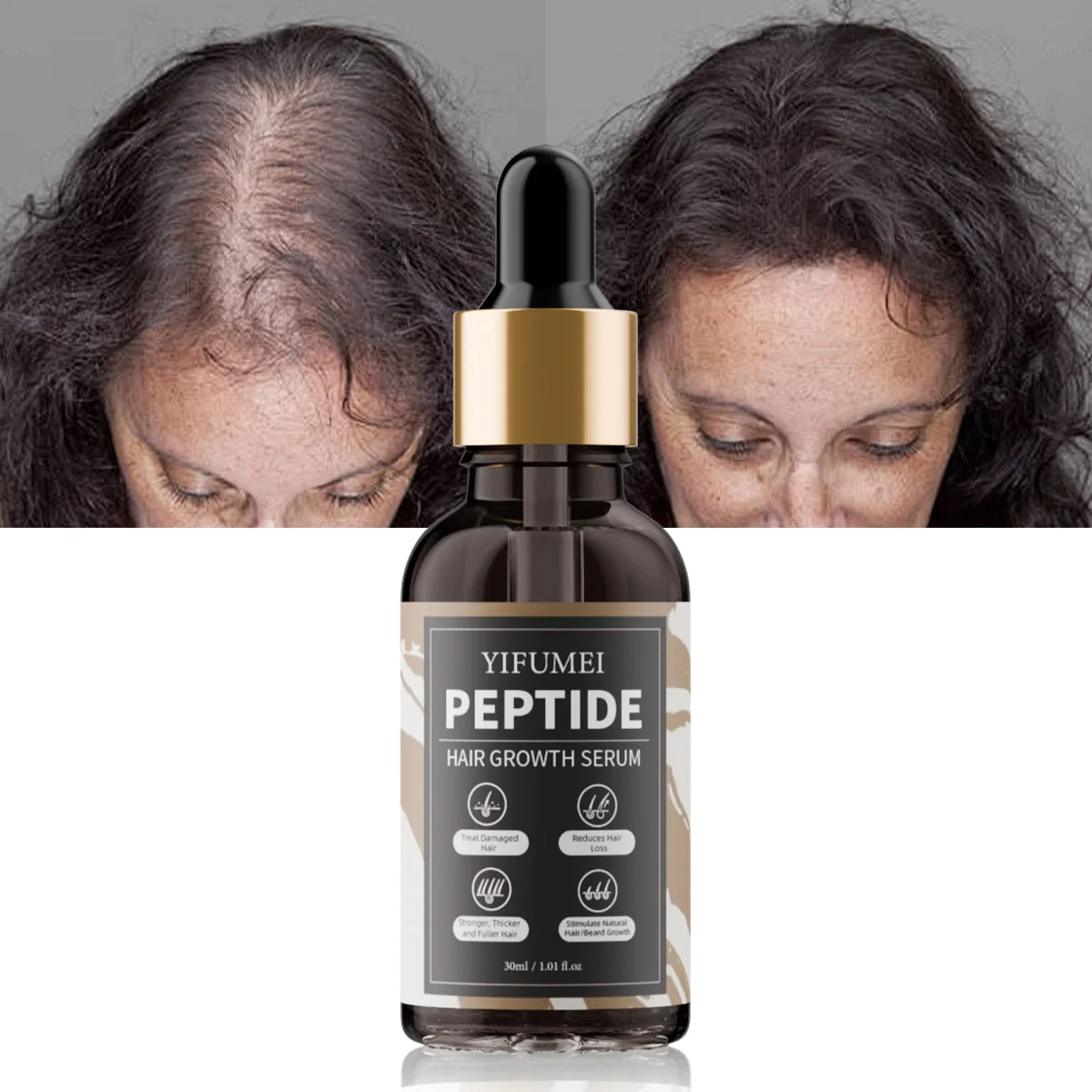 Custom Logo Biotin Hair Loss Growth Oil Peptide Tea Tree Care Treatment for Women and Men Thinning Hair Growth Serum Oil