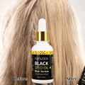 Custom Logo FATAZEN Black Seed Oil All Natural Formula Hair Growth Oil Rosemary Jojoba Nourishing Scalp Rapid Organic Hair Serum