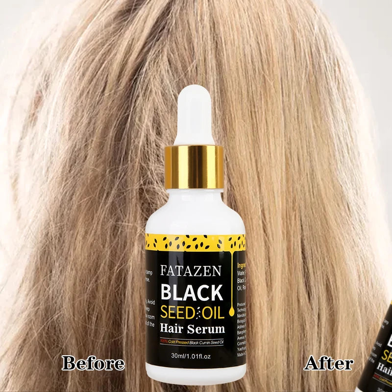 Custom Logo FATAZEN Black Seed Oil All Natural Formula Hair Growth Oil Rosemary Jojoba Nourishing Scalp Rapid Organic Hair Serum