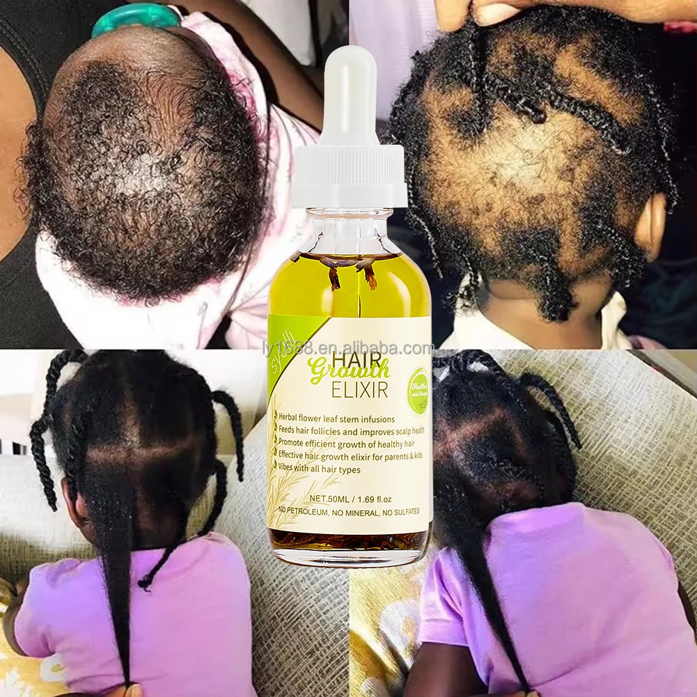 Private Label 100% Natural Formula Nourishing Scalp Elixir Castor Rosemary Oil Hair Care Loss Treatment Hair Growth Oil Serum