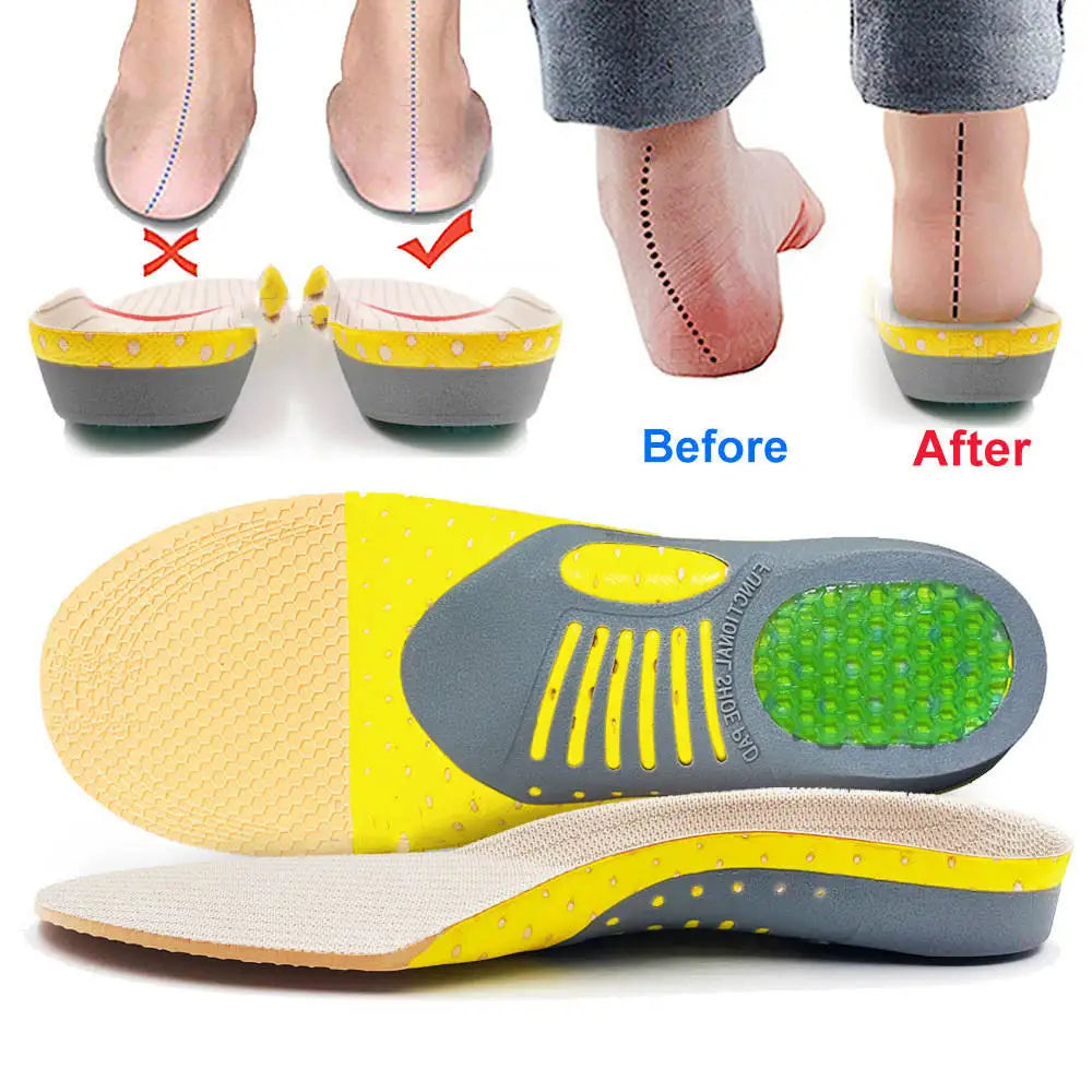Unisex Orthotic Gel Insoles Orthopedic Flat Foot Health Sole Pad for Shoes Insert Arch Support Pad for Plantar Fasciitis