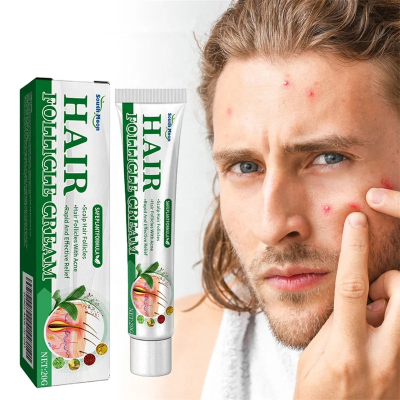 South Moon 20g Hair Folligle Cream Nourishing Scalp Folliculitis Follicular Acne Chin Swollen Lump Relieving Cream