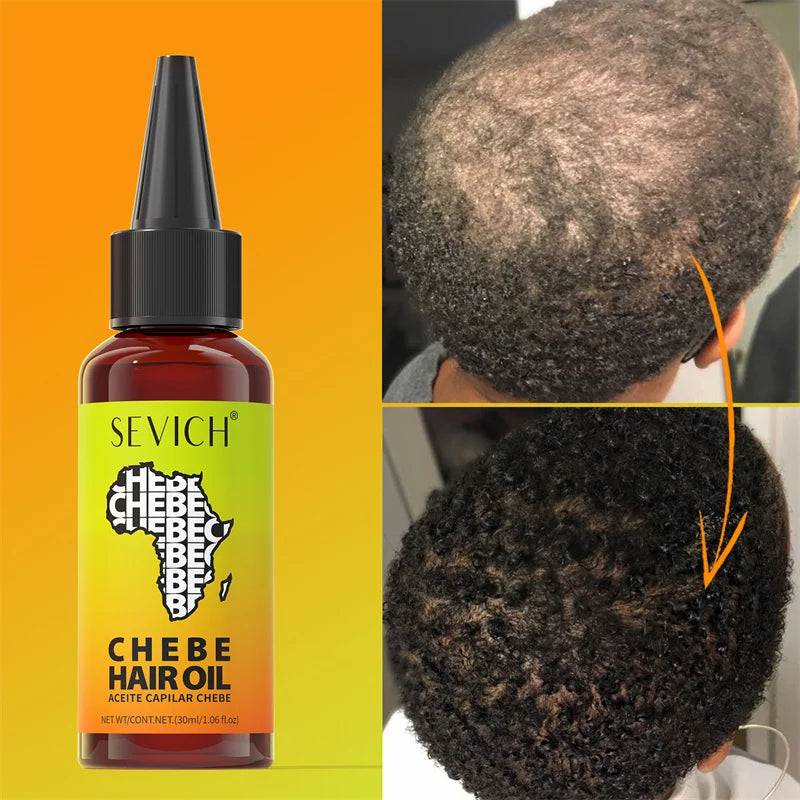 Chebe Hair Oil Oem Natural Moisturize Scalp 30ml Hair Growth Oil Serum Ampoule Private Label Hair Loss Treatment