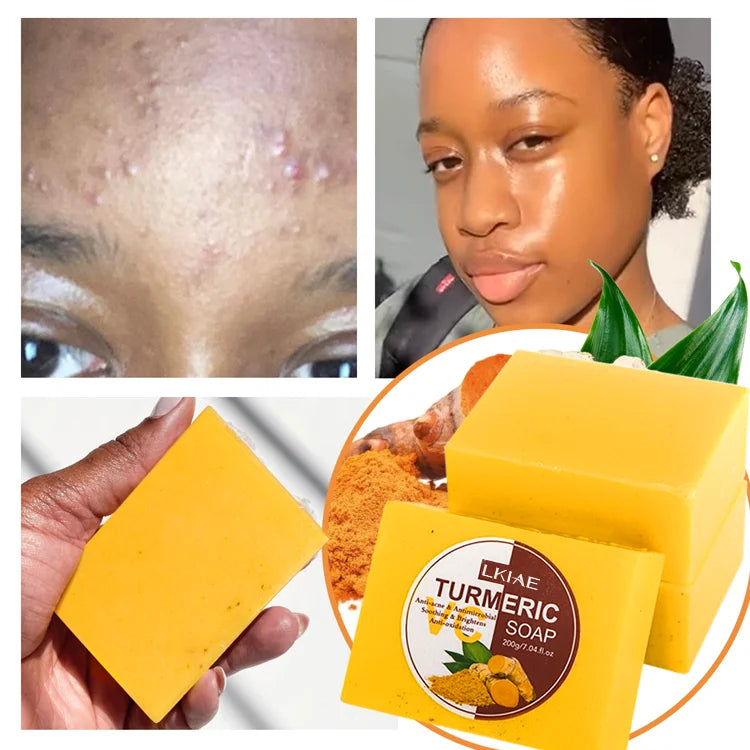 Private Label Wholesale 100% Organic Handmade Bar Soap Turmeric Anti-Acne & Lightening Solid Whitening Antiseptic for Bath Face