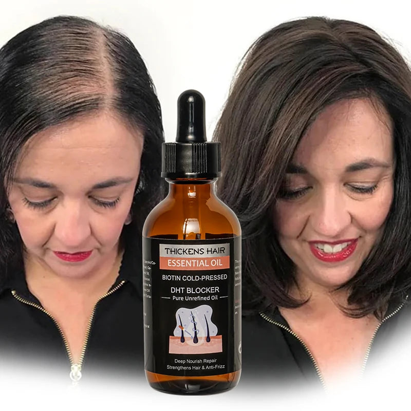 Personal Care Essential Oil Hair Regrowth Serum Biotin Regrowth Treatment for Scalp Hair Loss Unisex Thinning Hair Growth Oil