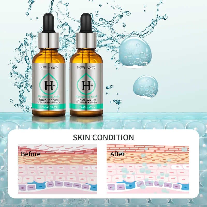 Hyaluronic Acid Serum for Skin 100% Pure Highest Quality Anti Aging Intense Hydration Moisture Non-greasy Hyaluronic Acid Serum
