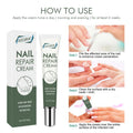 Hot Selling 20g EELHOE Nail Foot Toe Repair Removal Gel