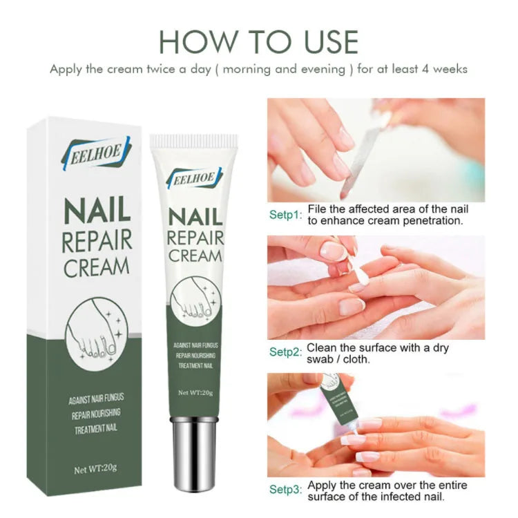 Hot Selling 20g EELHOE Nail Foot Toe Repair Removal Gel
