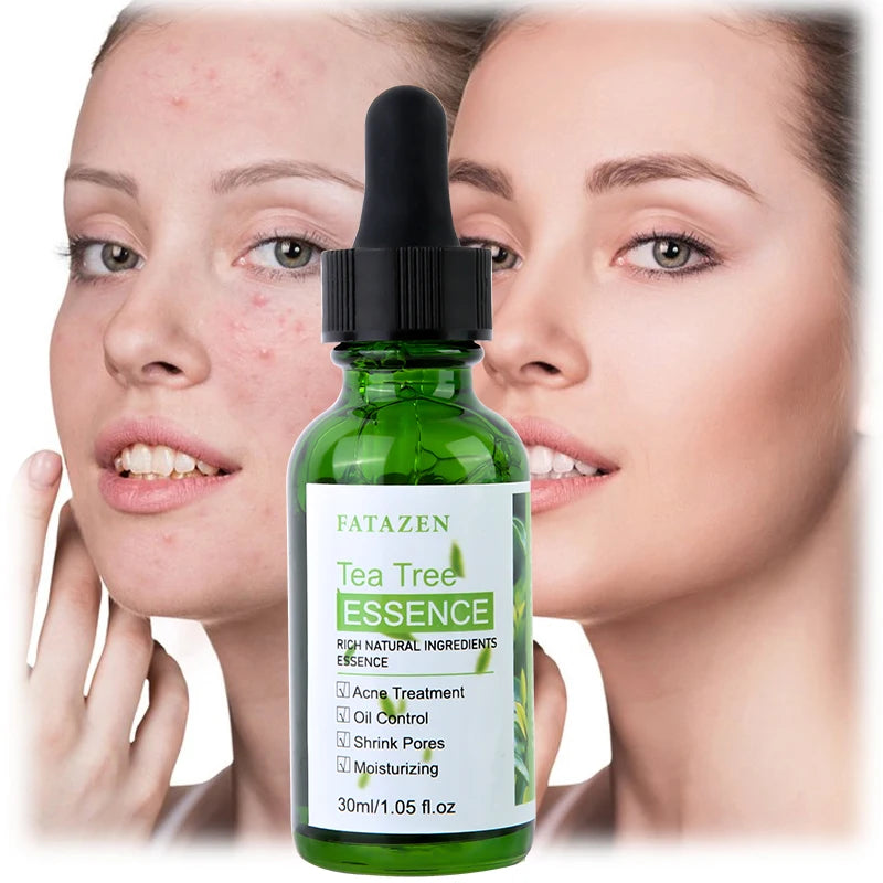 FATAZEN Private Label Hot Sale Herbal Tea Tree Face Serum Skin Care Organic Oil Control Moisturizing  Pimple Serum