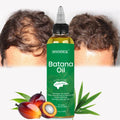 Hot Selling African Batana Oil for Hair Growth Repair Damage Hair Batana Oil Nutrafol Women's Balance Hair Growth Supplements