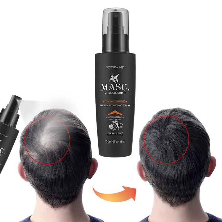 130ml Mens Grooming Hair Growth Hair Thinning Treatment and Prevention Anti Hair Loss Spray