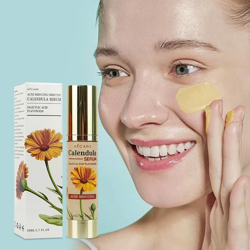 Customised Anti-Acne Face Serum Paraben-Free Oil-Control & Nourishing with Calendula & Squalane Anti-Wrinkle Liquid for Home Use