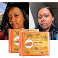 OEM/ODM Vitamin Kojic Moisturizing Acne Removal Dark Spot Facial Beauty Papaya Soap for Glowing Skin