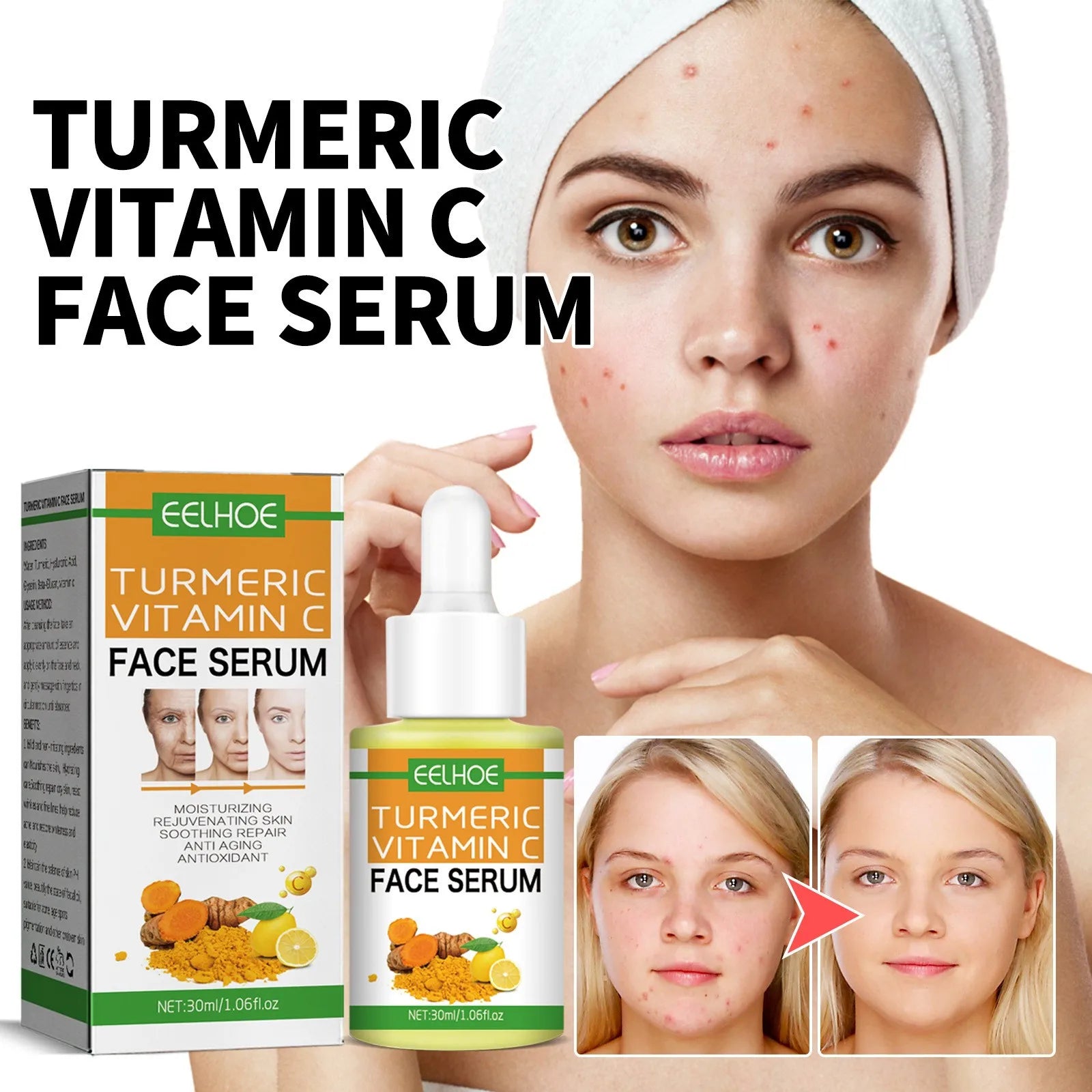 Wholesale Moisturizing Acne Remover Natural Ingredients Turmeric Extract Face Care Brightening Whitening Vitamin c Serum