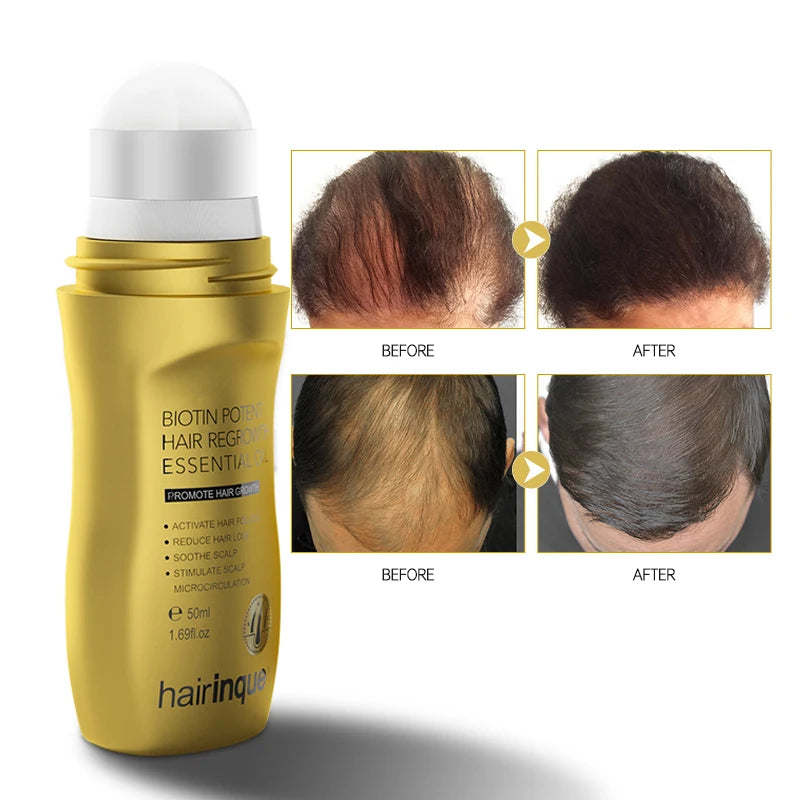 Hair Loss Treatment Natural Biotin Regrowth Essence Serum Hair Growth Oil Private Label