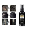 100ml Organic Hair Growth Serum 5% Biotin Spray for Men Women Hair Regrowth Treatment