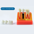 Durable Plastic Dental Teeth Model 4 Times Teaching Model for Doctor-Patient Multi-Purpose Teeth Whitening Accessories