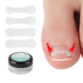 Nail Glue Sticker Corrector Strips Brace Toe Nail Treatment Patch Sticker Corrector Pedicure Tools Toenails Correction Foot Tool