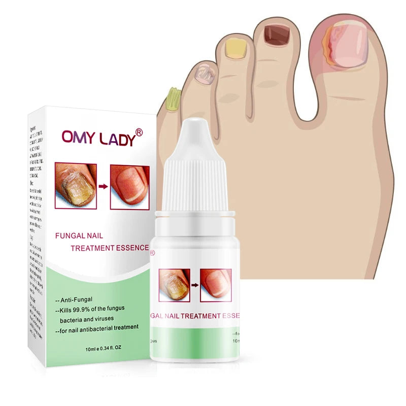 Fast Results for All Kinds Foot Fungal Infection 10ml Advanced Fungal Repair Solution