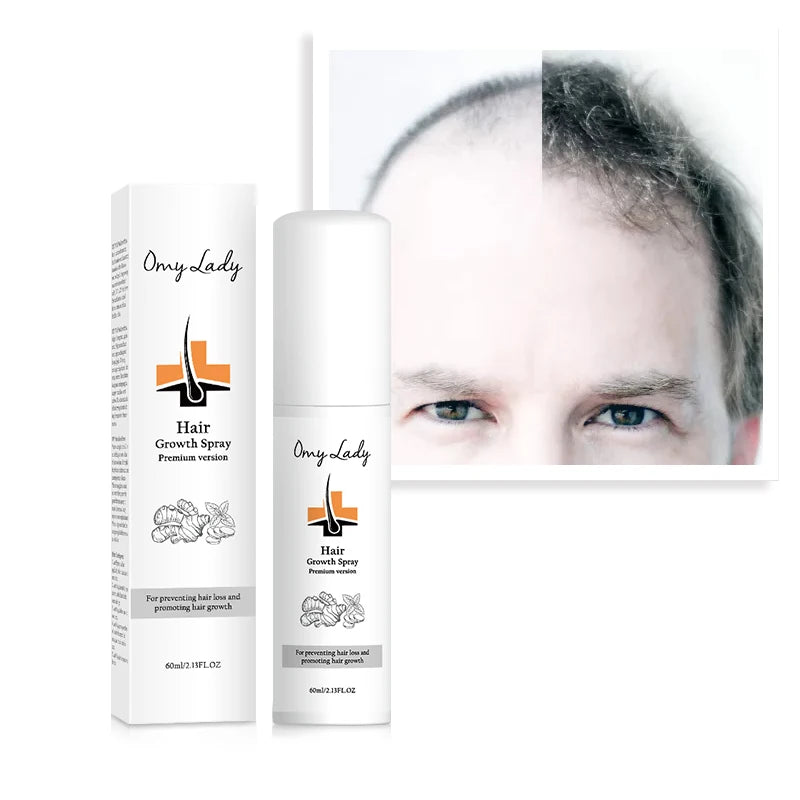 Free Private Label Salon Products Anti-dandruff Anti Hair Loss- for All Hair Types Sample Treatment of Hair Loss
