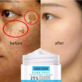 OEM Private Label Face Care Cream Effective for Acne Pigmentation Melasma Dark Spots Whitening Pigment Melanin Freckle Removal"