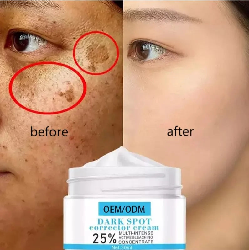 OEM Private Label Face Care Cream Effective for Acne Pigmentation Melasma Dark Spots Whitening Pigment Melanin Freckle Removal"