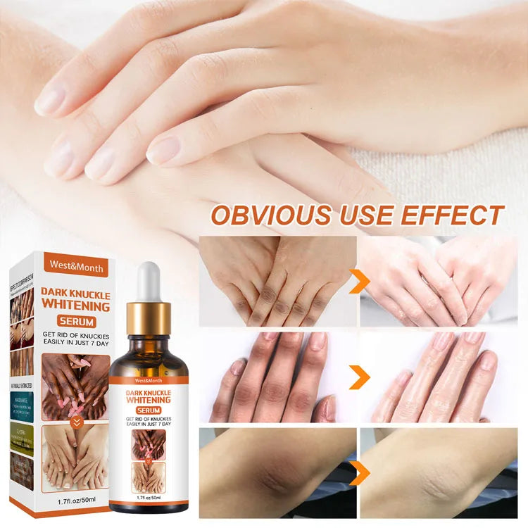 Wholesale Knee Lightening Melanin Removal Tone Ankle Joints Moisturizing Skin Whitening Serum
