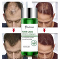 Hair Care Oil That Repairs and Dyes Damaged to Prevent Hair Loss Hair Treatment Essence Oil
