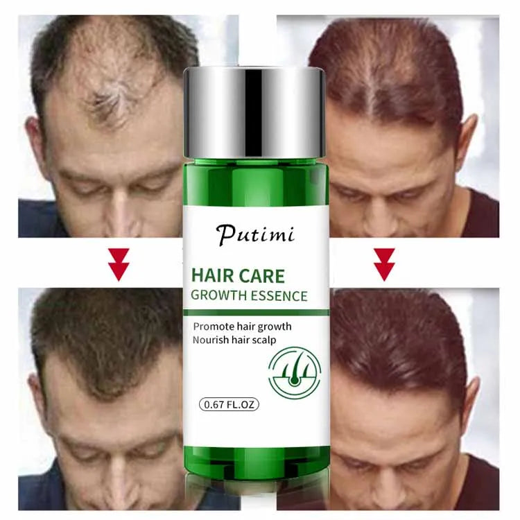 Hair Care Oil That Repairs and Dyes Damaged to Prevent Hair Loss Hair Treatment Essence Oil