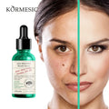 Private Label KORMESIC OEM Organic Anti Aging Brightening Wrinkle Face Vitamin C Serum Whitening Serum for Skin Lightening Serum