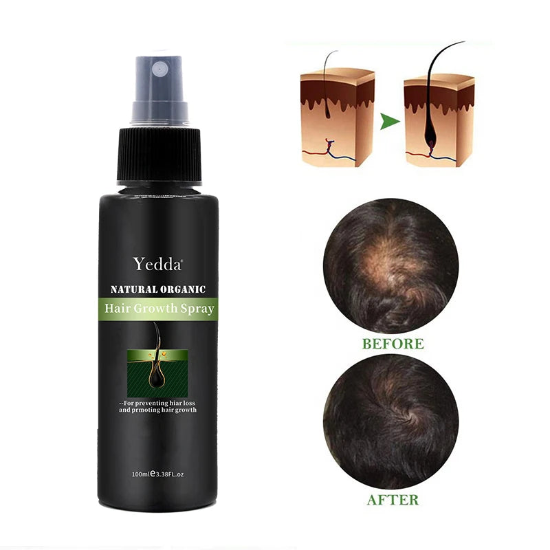 OEM Yedda Natural Anti-Hair Loss Growth Cream 2-IN-1 Formula Unisex Organic Plant Extract Hair Growth Treatment for All Hair