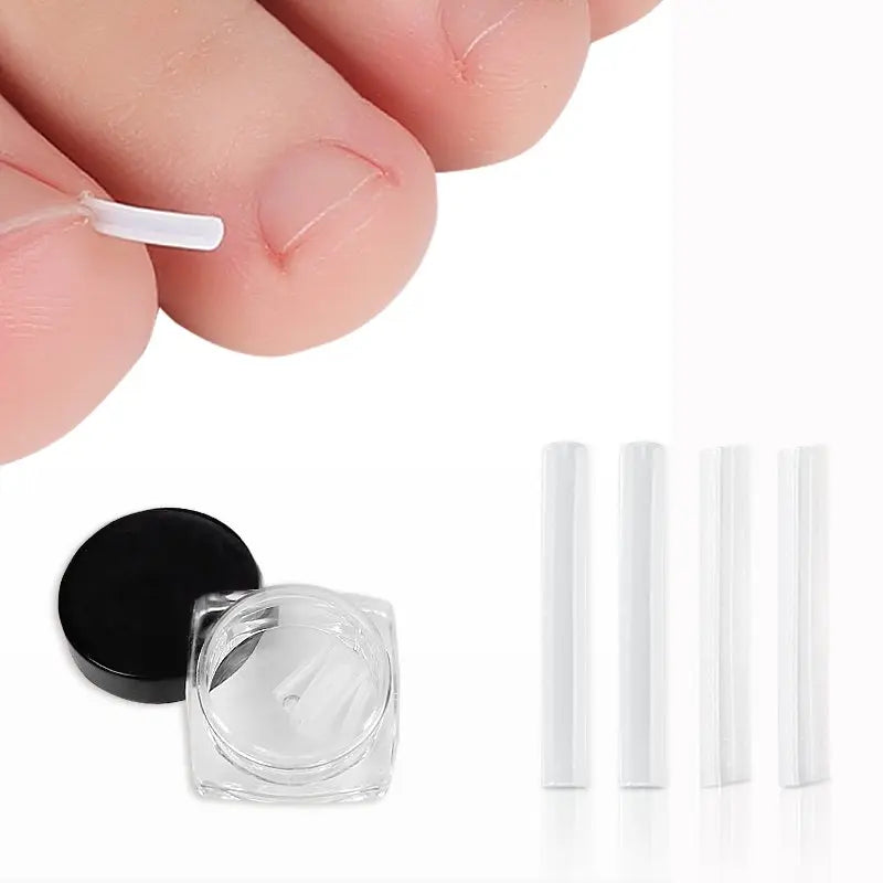 10pcs/set Ingrown Nail Pad Elastic Toenail Care Sticker Glue Patches Manicure & Pedicure Corrector Pad