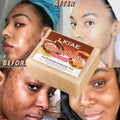2026 Best Vitamins Oat Niacinamide Healthy Vegan Organic Beauty Face Natural Whitening Handmade Soap for Black Skin