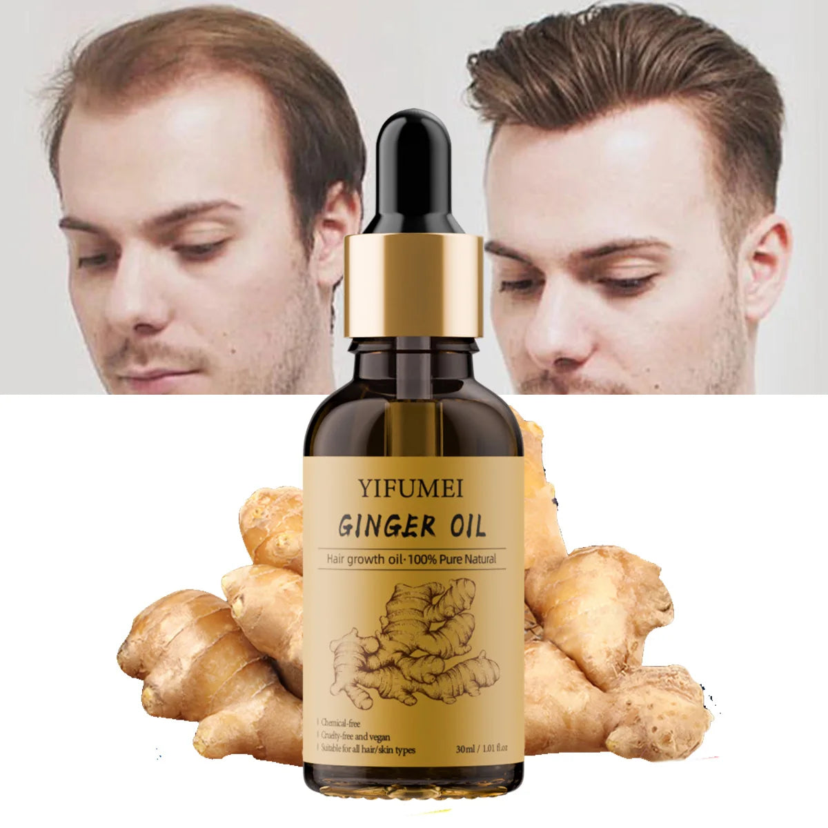 Private Label Natural Rosemary Anti-Hair Loss Scalp Vegan Black Hair Care Loss Treatment Ginger Hair Growth Serum Oil