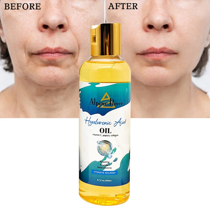 Private Label Alpine River 100% Natural Organic Vitamin C Papaya Hyaluronic Acid Skin Moisturizing Firming Skin Body Massage Oil