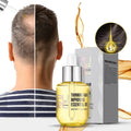 PURC Hair Density Essential Oil Natural Organic Ginger Oil Hair Growth Oil Anti Hair Loss Regrowth Serum Private Label