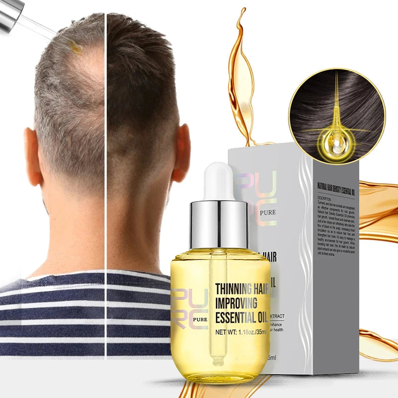 PURC Hair Density Essential Oil Natural Organic Ginger Oil Hair Growth Oil Anti Hair Loss Regrowth Serum Private Label