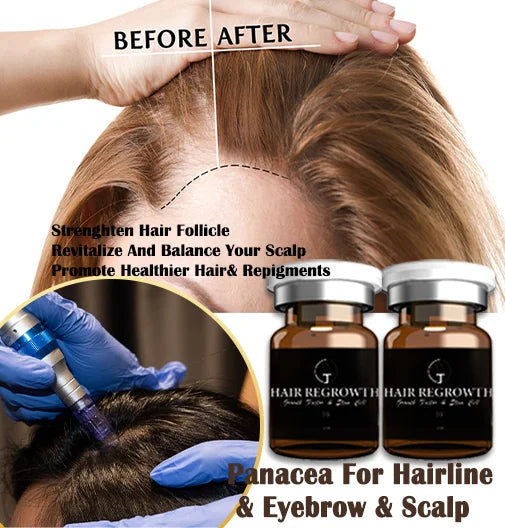 ZS Newest EGF Hair Regrowth Micro-infusion Serum Strengthen Follicle Anti-Hair Loss Peptide & Stem Cell Fast Hair Growth Ampoule