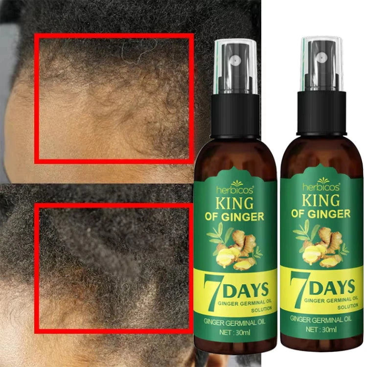 Wholesale Factory Price Hair Regrowth Oil OEM/ODM Private Label Hair Treatment Lotion Spray Anti-Hair Loss Repairing Features