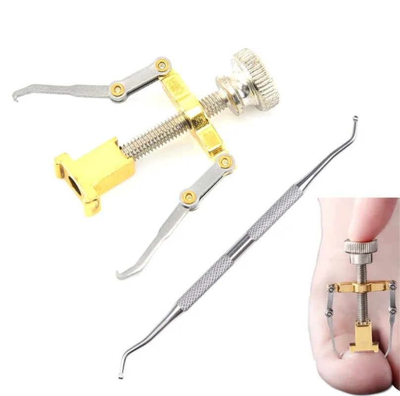 Ingrown Toe Foot Nail Correction Fixer Nail Pedicure Tool Toenail Corrector Pedicure Tools Set Paronychia Treatments Foot Care