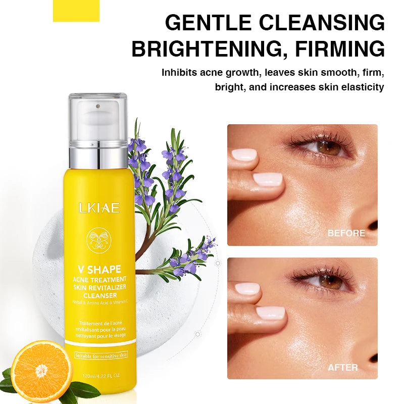 Private Label Amino Acid Acne Anti-Aging Cream Deep Cleansing Vitamin C Face Foaming Facial Cleanser for Sensitive Skin