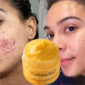 OEM Organic Turmeric Face Cream for Woman Anti Wrinkle Anti Pimple Acne Remover Whitening Body Face Cream Beauty Personal Care
