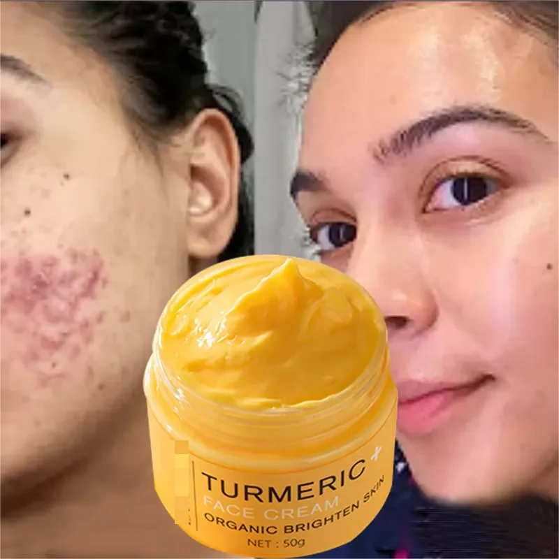 OEM Organic Turmeric Face Cream for Woman Anti Wrinkle Anti Pimple Acne Remover Whitening Body Face Cream Beauty Personal Care