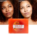 OEM Face Cleansing Anti-Aging Korean Skin Care Product Face Skin Care Whitening and Removing Dark Spots Turmeric Soap for Women