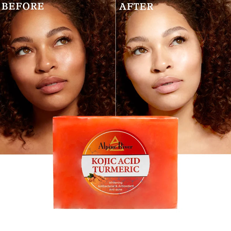 OEM Face Cleansing Anti-Aging Korean Skin Care Product Face Skin Care Whitening and Removing Dark Spots Turmeric Soap for Women