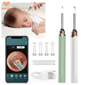 Pakiss Promotional  Ear Wax Vacuum Cleaner Smart Removal Tool From Otoscope