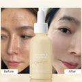 Factory Direct Sale Anti Aging Whitening Face Serum Niacinamide Serum Anti Aging  Vitamin C Face Serum