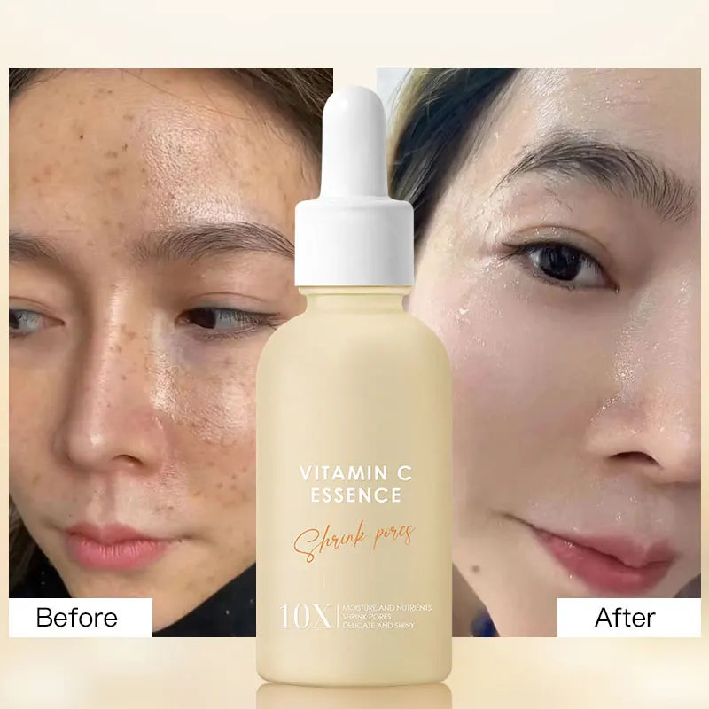 Factory Direct Sale Anti Aging Whitening Face Serum Niacinamide Serum Anti Aging  Vitamin C Face Serum