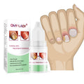 Yunnan Balala Pocket Size Finger & Toe Serum Vinegar for Nail Fungus